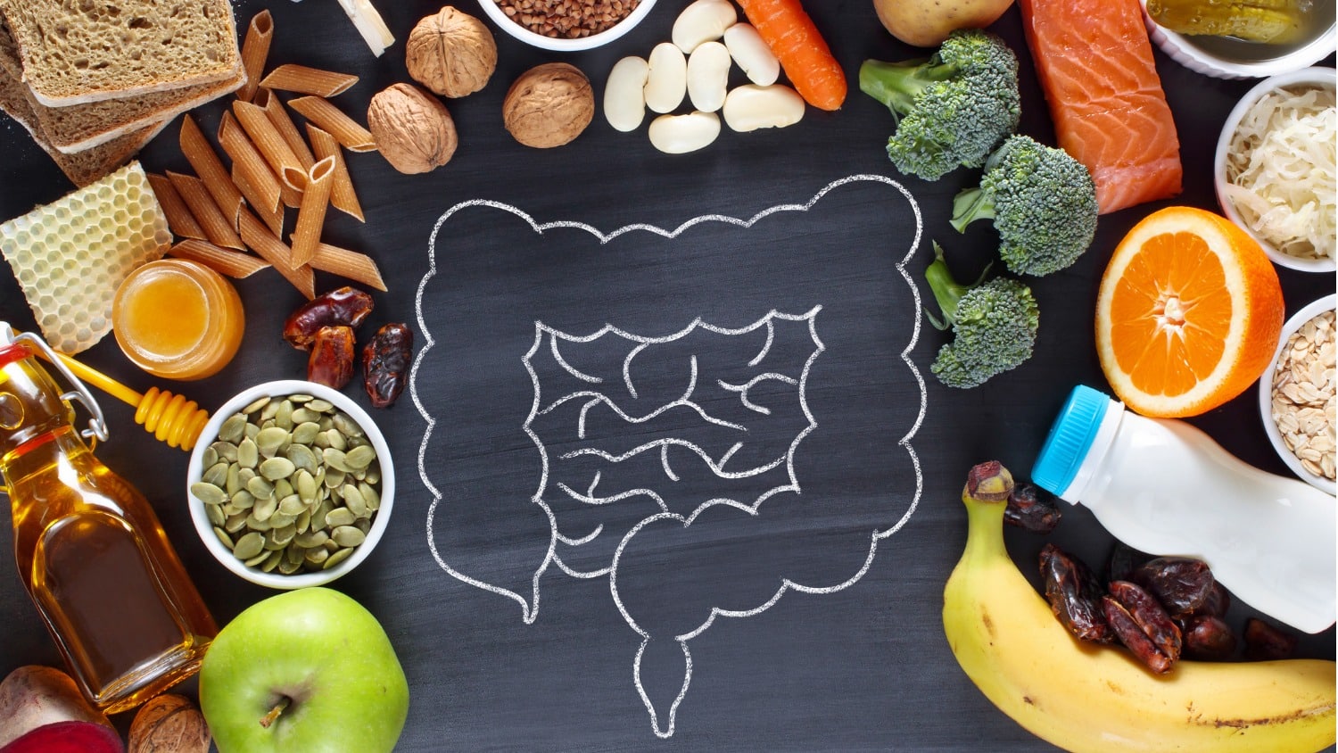 My Healthy Gut Story – How Eating 30 Plants a Week Gave Me Back My Life ...